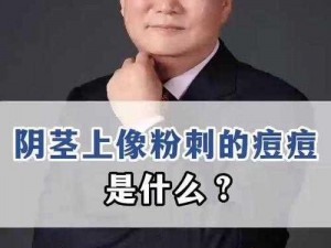 软起不来什么原因_为什么会出现阴茎软起不来的情况？