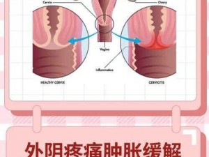 女生一天多次同房会肿胀吗;女生一天多次同房会阴部肿胀吗？