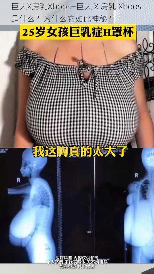 巨大X房乳Xboos—巨大 X 房乳 Xboos 是什么？为什么它如此神秘？